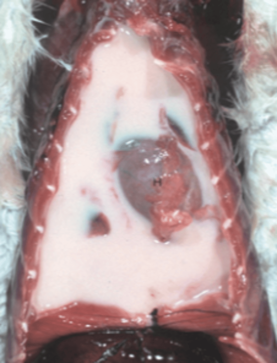 <p>How would you classify the eitology of this lesion?</p><p>A. toxic</p><p>B. iatrogenic</p><p>C. neoplastic</p><p>D. degenerative</p><p>E. infectious</p>