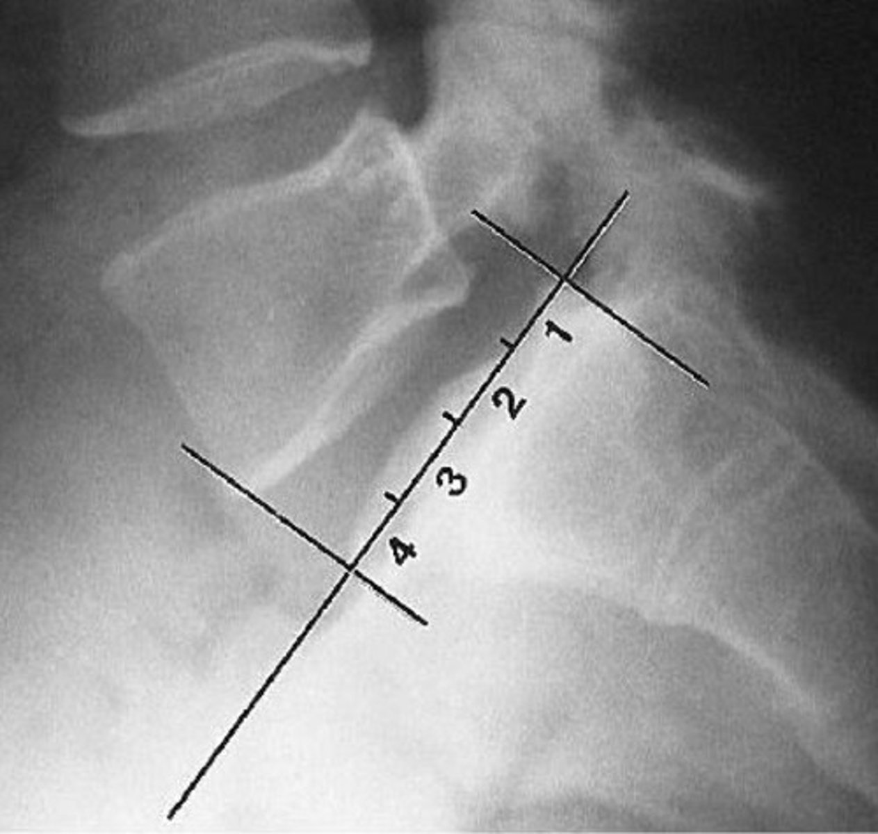 <p>What line of mensuration is this?</p>