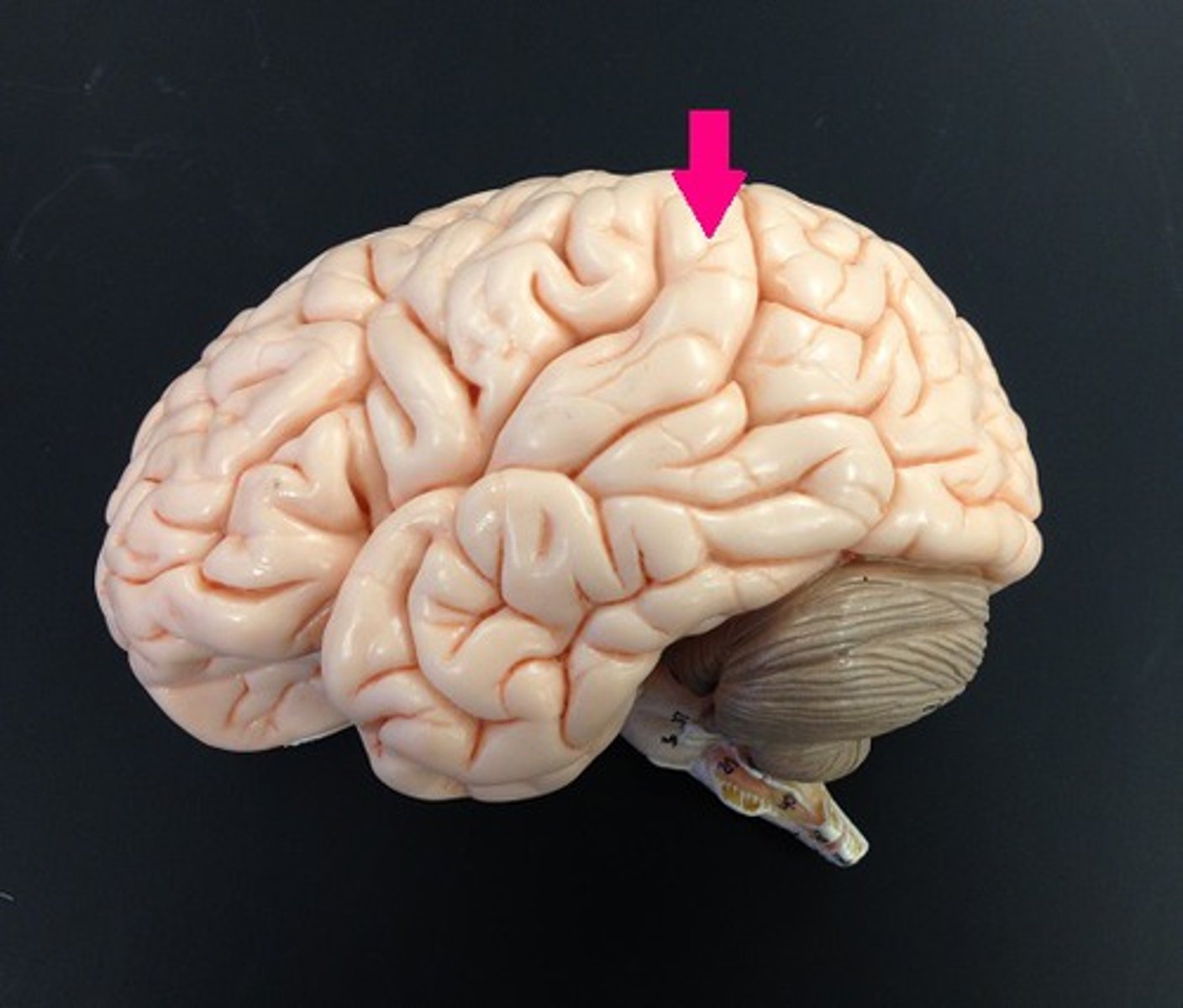 <p>Identify the lobe.</p>