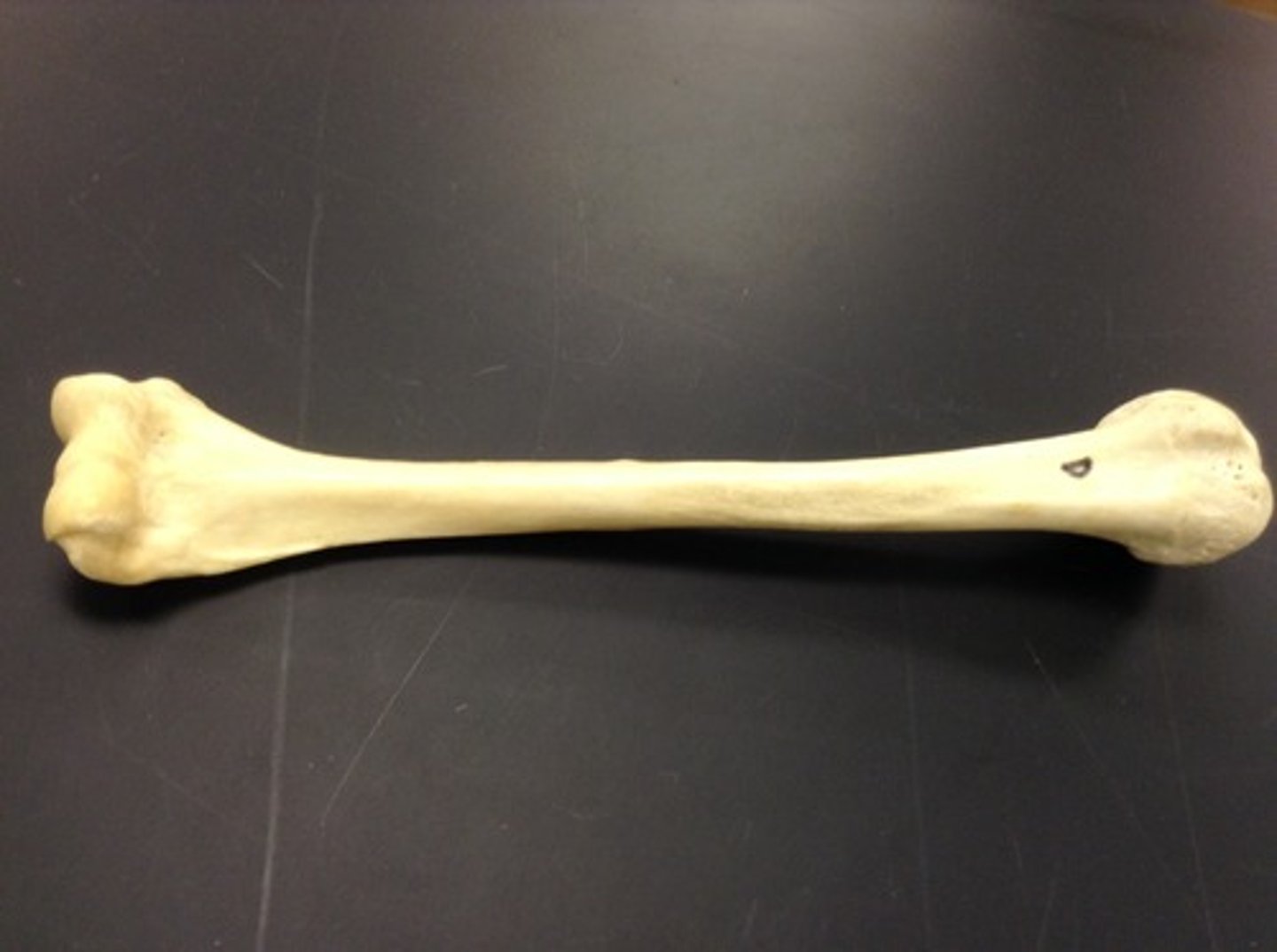 <p>ID bone</p>