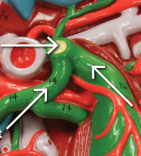 <p>top left arrow </p>