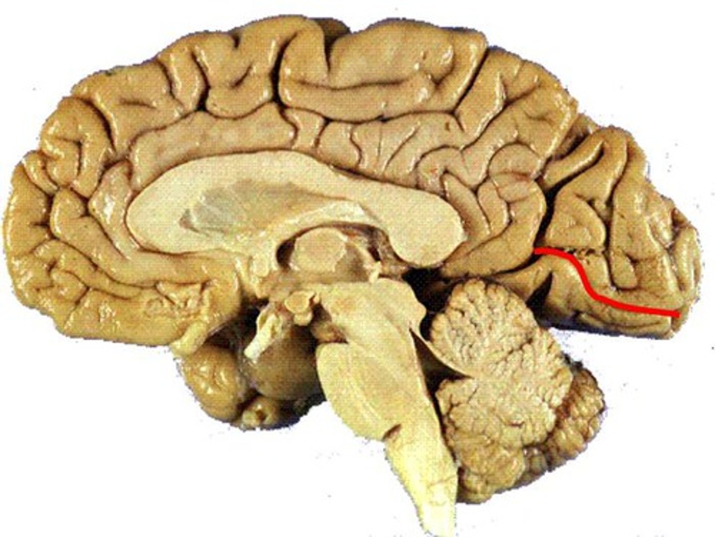 <p>Located in the occipital lobe, runs roughly perpendicular to the parieto-occipital sulcus. Contains the primary visual cortex.</p>