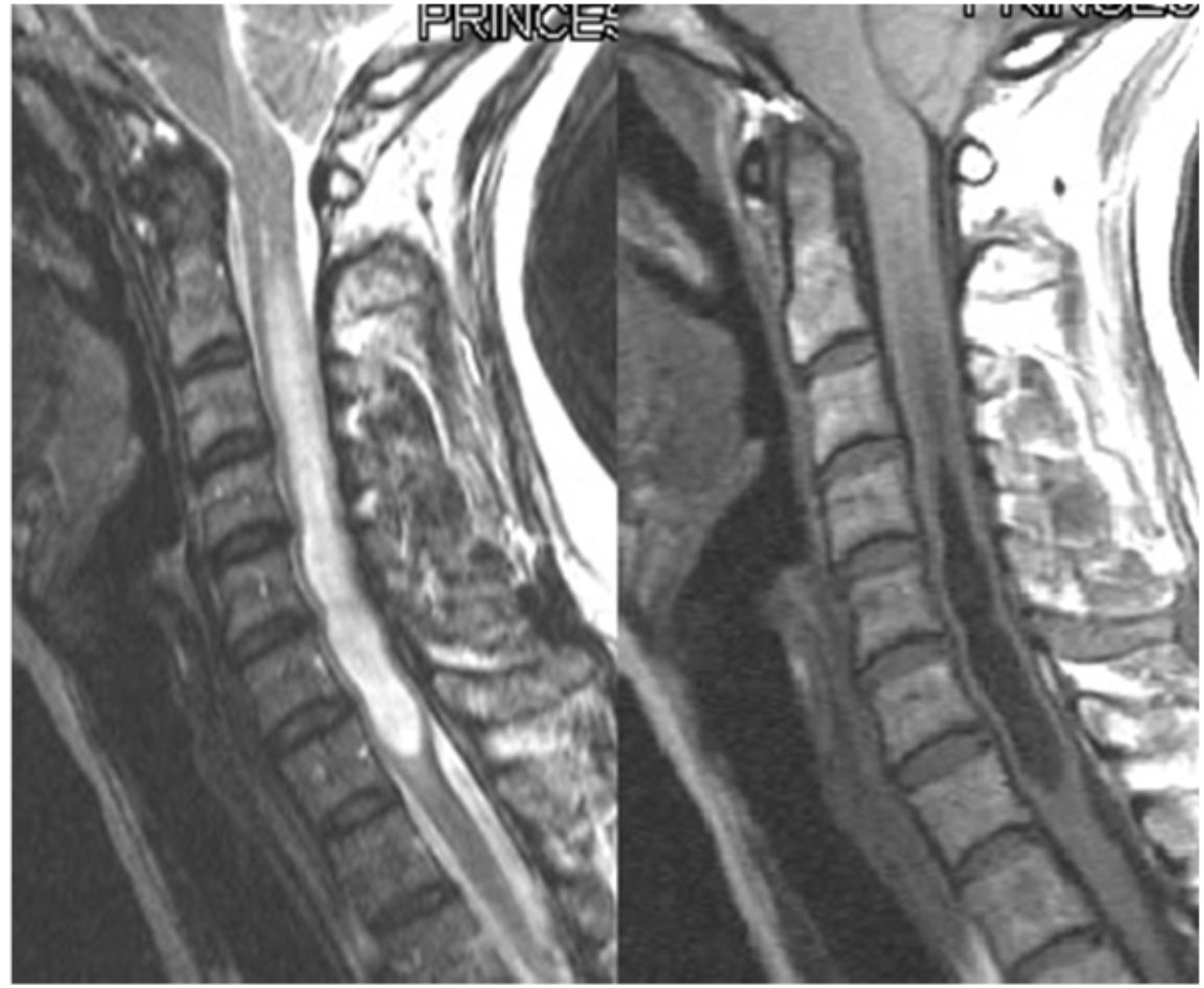 <p>Name the pathology and explain what is it.</p>