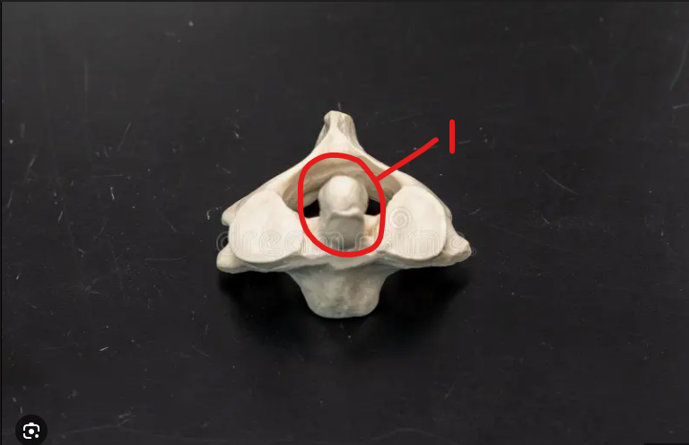 <p>what is this structure </p>