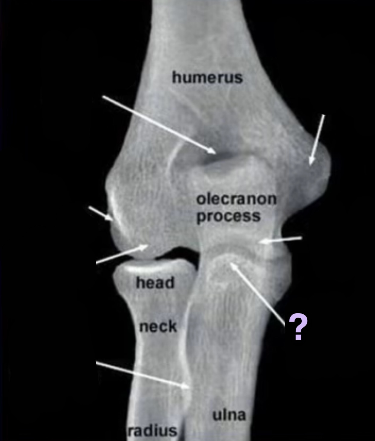 term image