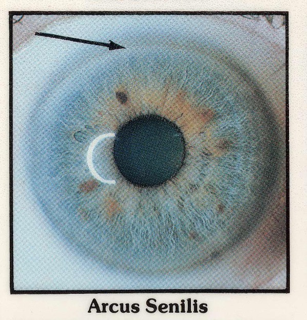 <p>what is the arrow pointing to?</p>