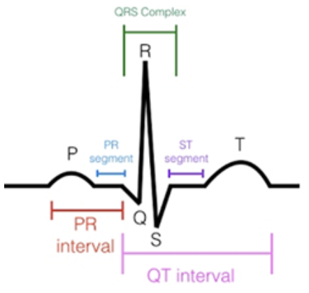 <ul><li><p>initial (first) <strong>negative (downward) </strong>deflection following P wave</p></li><li><p><u>precedes</u> <strong>R wave</strong></p></li></ul><p></p>