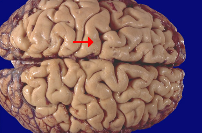 <p>Label this brain structure</p>