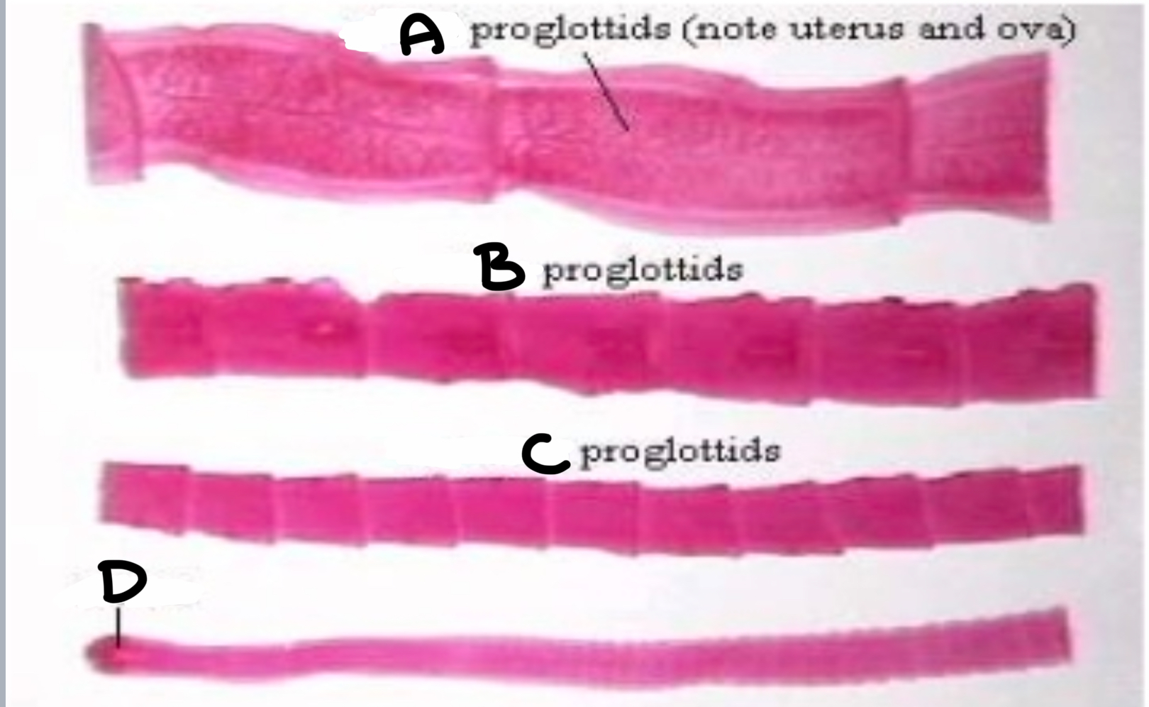 <p>What proglottid is labeled A</p>