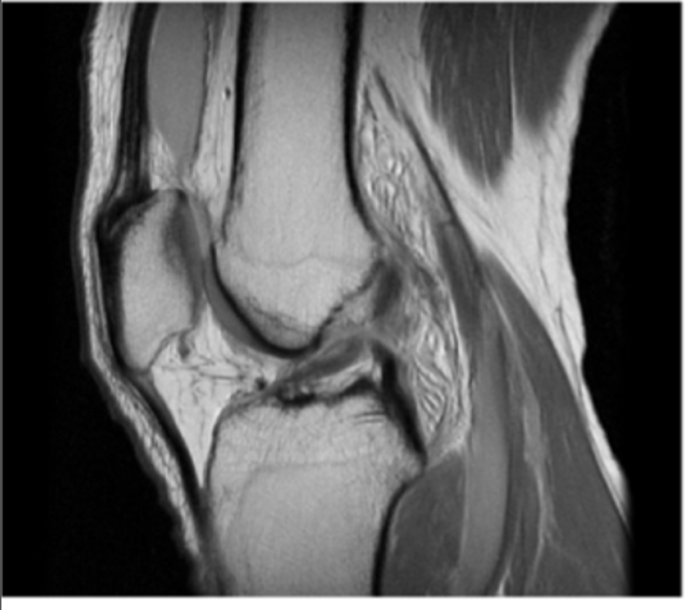 <p>Define the pathology.</p>