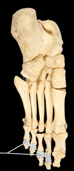 <p>Name this group of bones.</p><p>(Inferior view, left side).</p>
