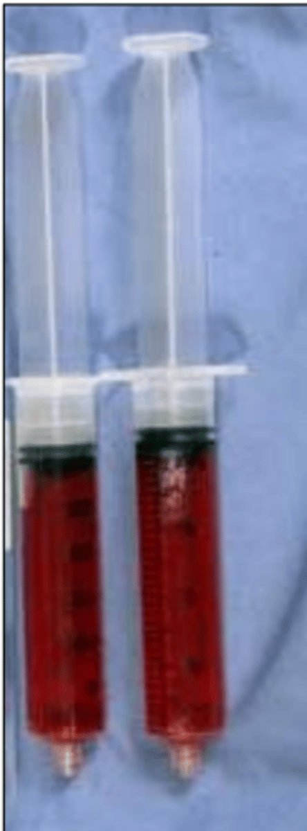 <p>what type of exudate is depicted in the image?</p>