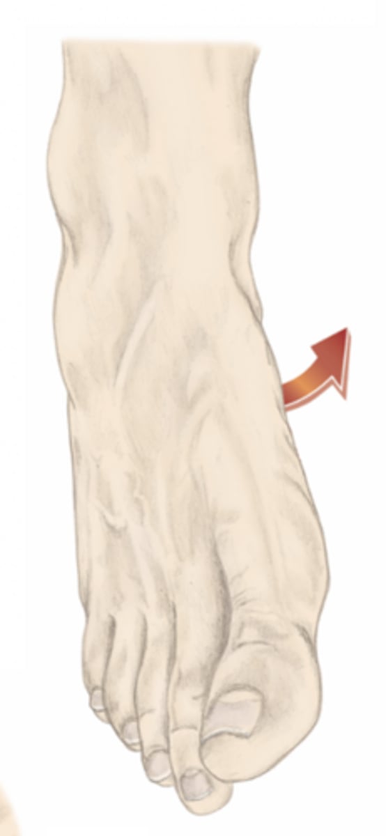 <p>please identify the movement and its location</p>