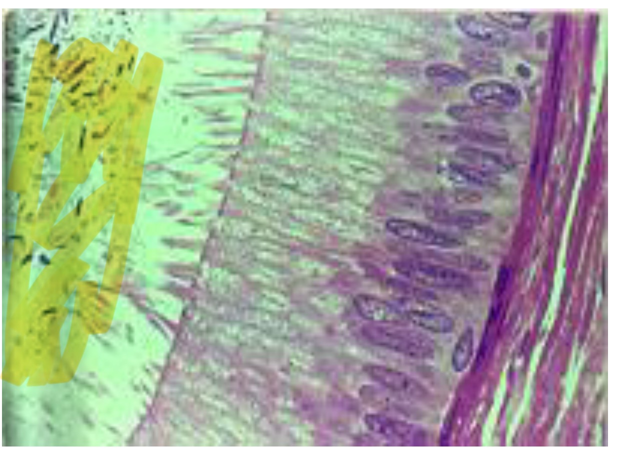 term image