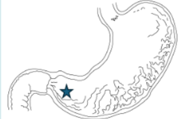 <p>What part of the stomach is indicated by the star?</p>