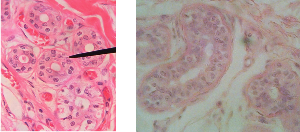 <ul><li><p>Multiple layers of cube-shaped cells (apical layers or cuboidal)</p></li><li><p>A rare type of epithelium found in the ducts of adult sweat glands and the male urethra</p></li><li><p>Location: exocrine glands (sweat glands)</p></li></ul>