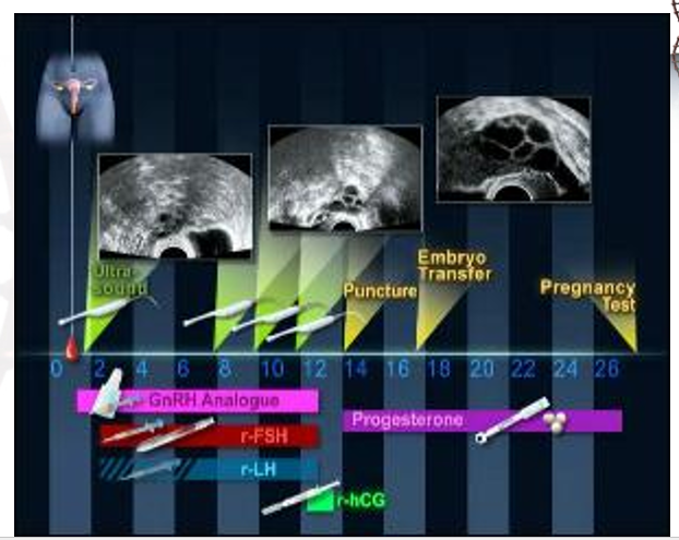 <p>what is shown?</p>