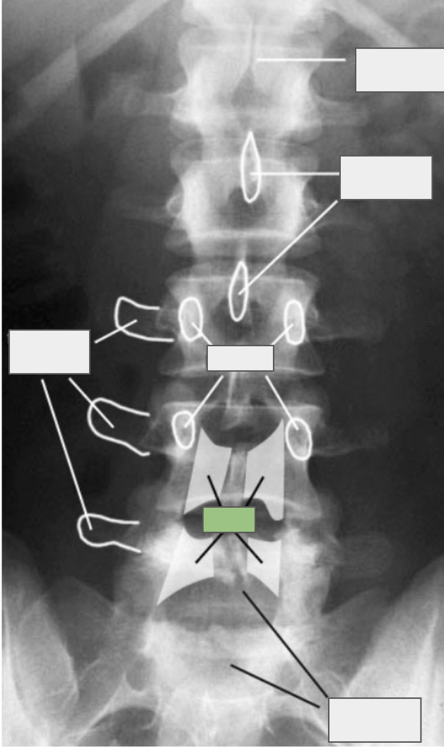 <p>What is referenced by the box highlighted in green?</p>