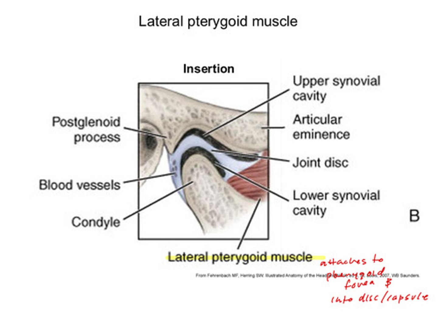 <p>attaches to the pterygoid fovea &amp; into disc/capsule</p>