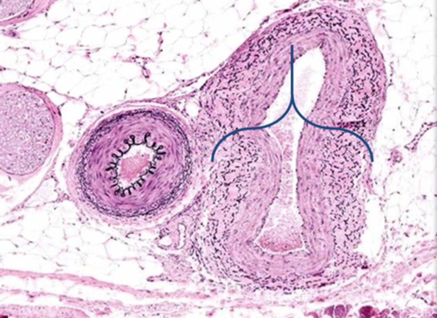 <p>Is this an artery or a vein?</p>