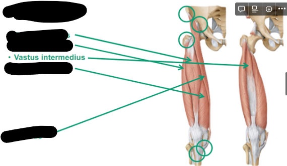 <p>Describe Vastus Intermedius thigh muscle </p>