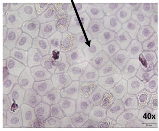 <p>What is this epithelial tissue?</p>