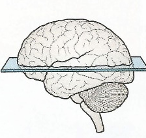 <p>top and bottom</p>