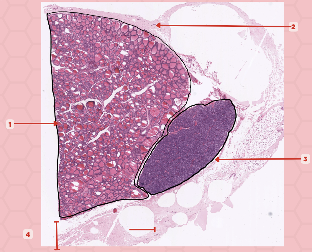 <p>Identify the structure labeled as 1.</p>