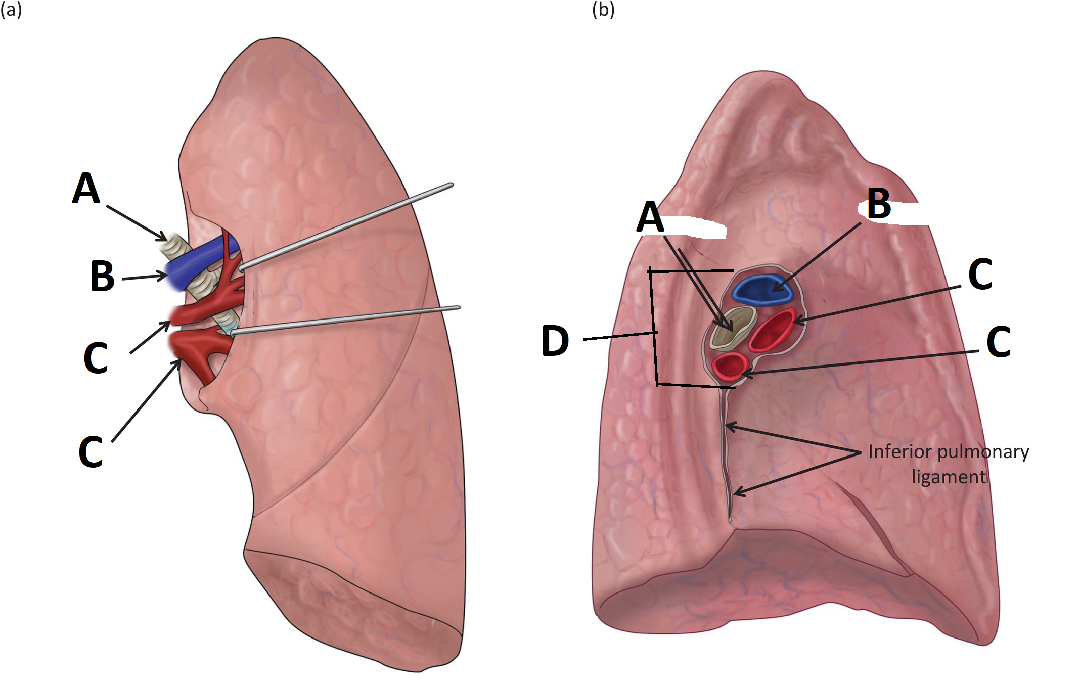 <p>B</p>
