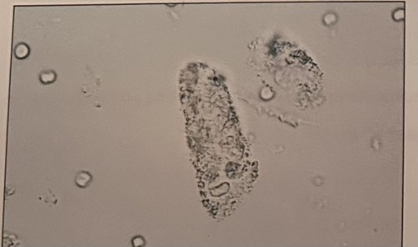 <p>d. granular</p>
