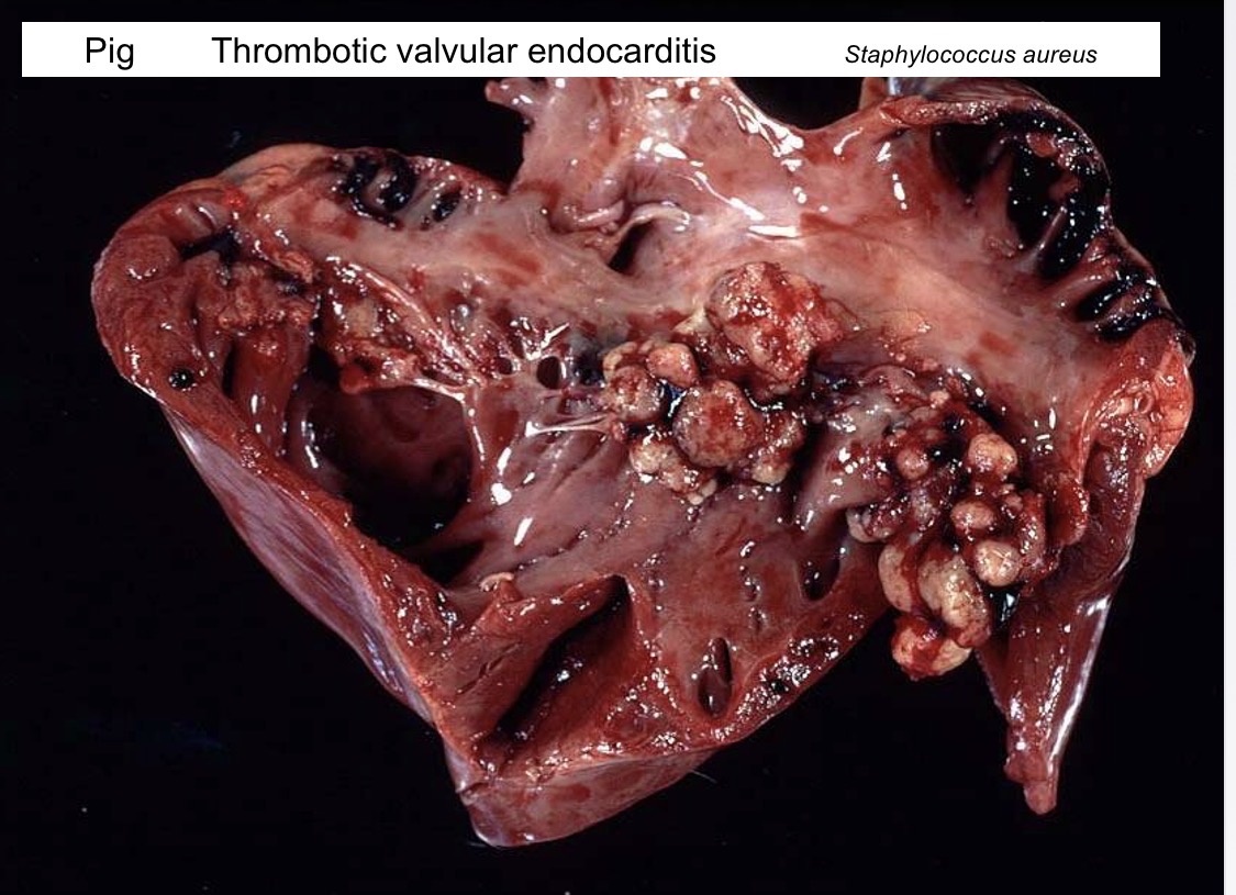 <p>endocardial diseases- ulcerative endocarditis gross</p>