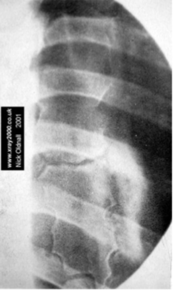 <p>What view is this?</p>