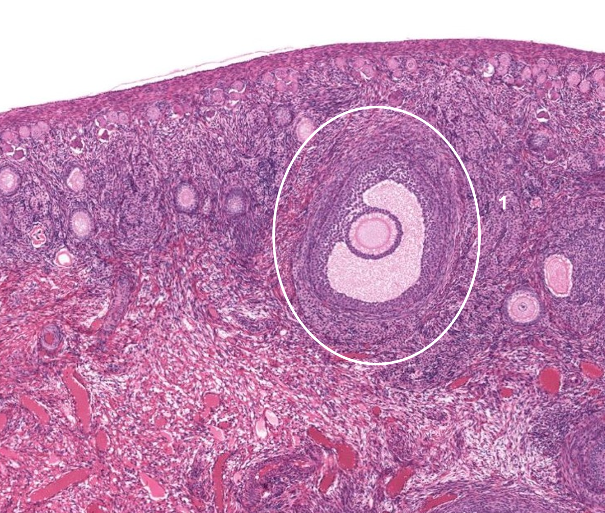 term image