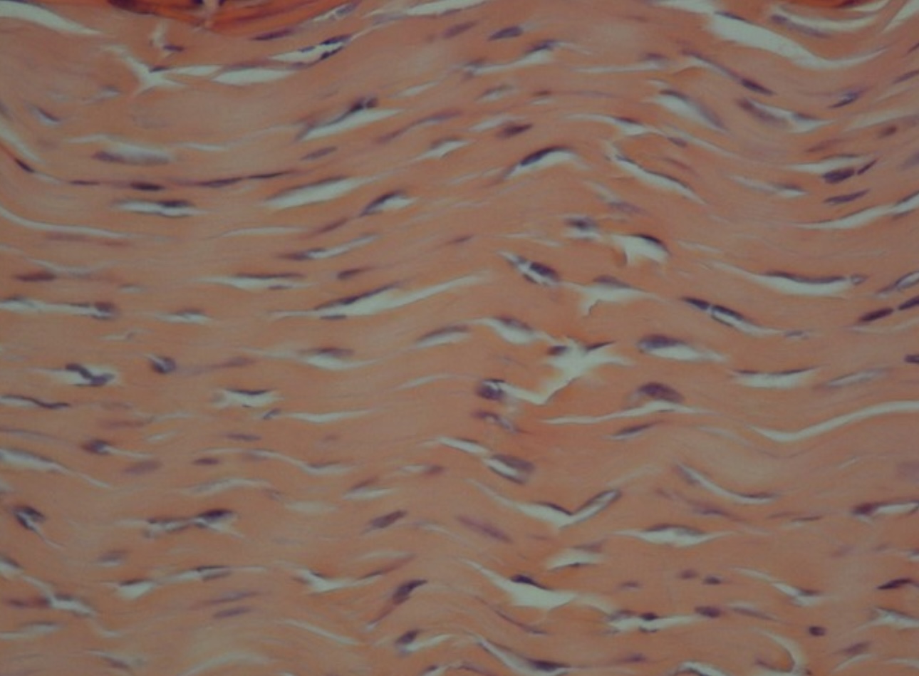 <p>Dense Regular Connective tissue</p>