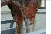 <p>Margin of the lesion</p>