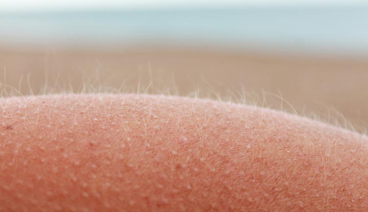 <p>Vellus (Hair)</p>