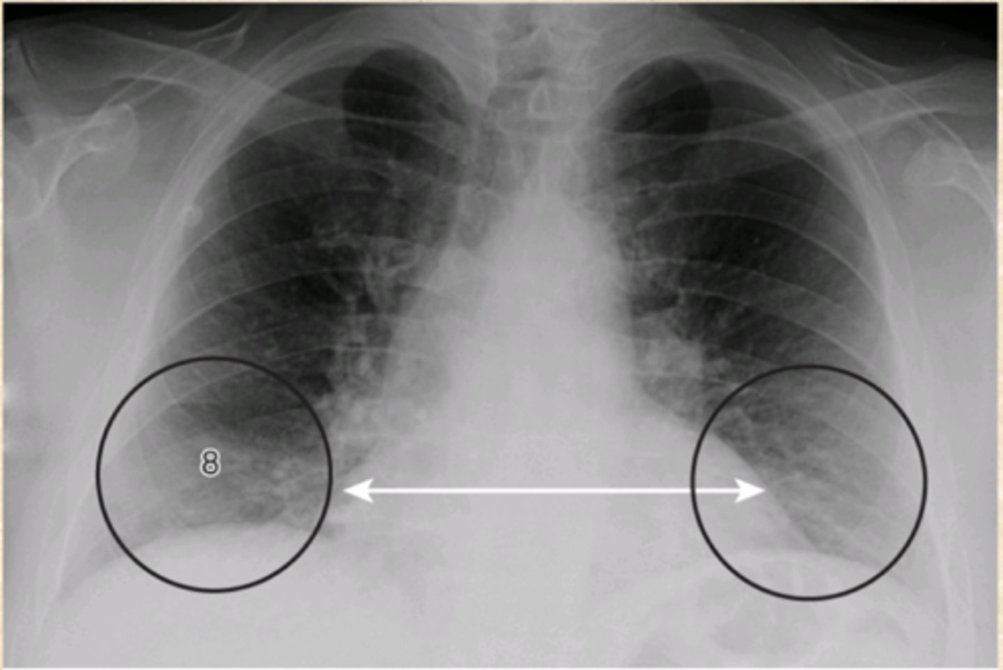 <p>What is wrong with this CXR?</p>