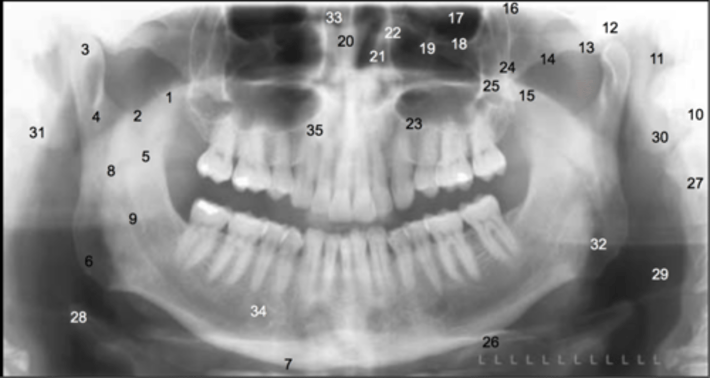<p>number 30</p>