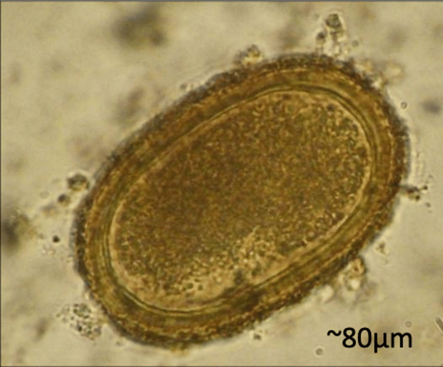 <p>Found in chickens in poor conditions and have a poor FCR. What parasite species does this egg belong to?</p>
