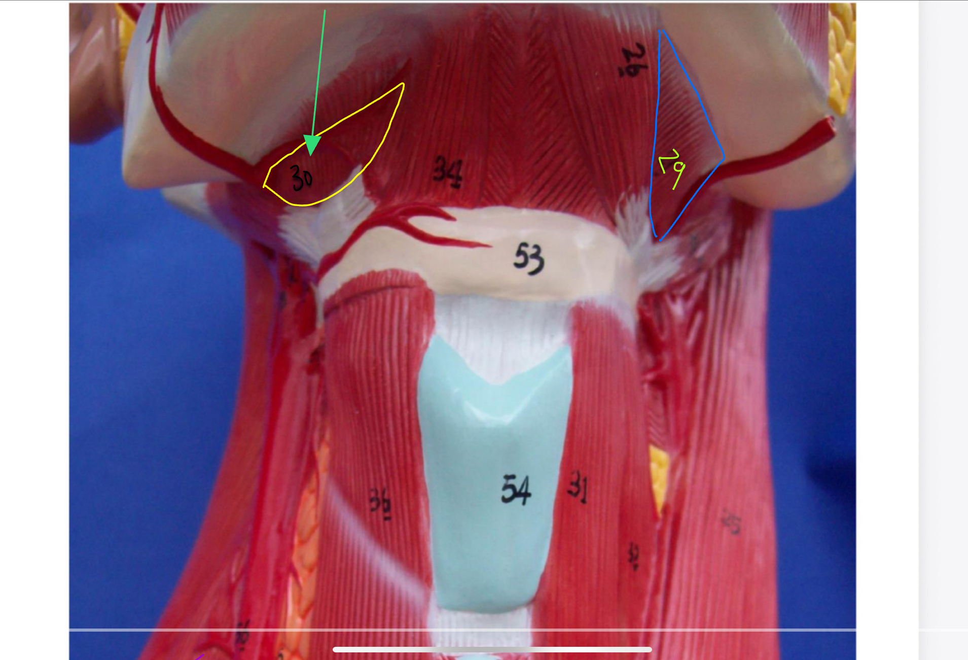<p>What type of muscle is this ( altay model )</p>