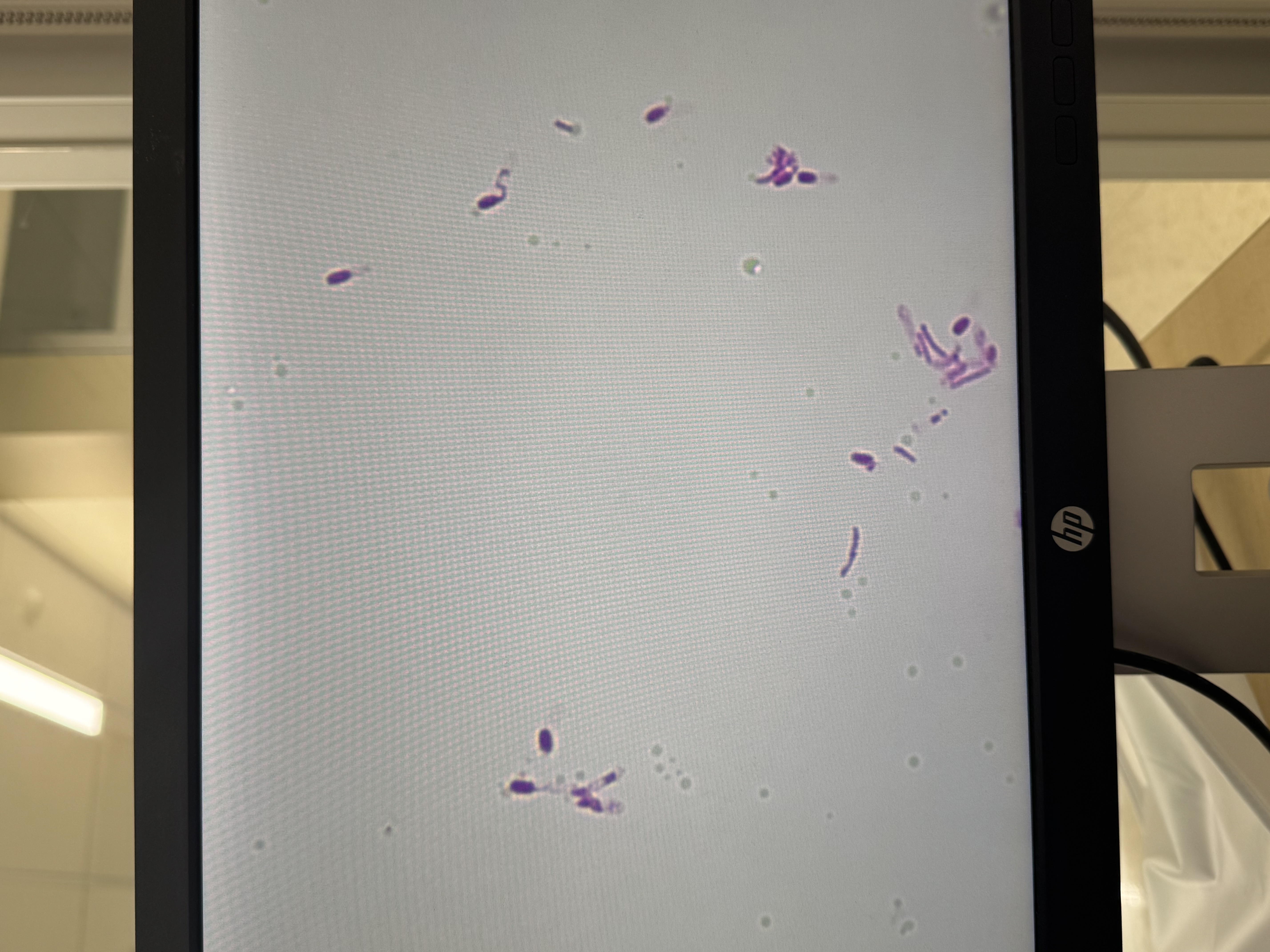 <p>Clostridium tetani</p>