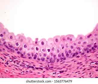 <p><strong>made up of several layers of cells that become flattened when stretched</strong></p>