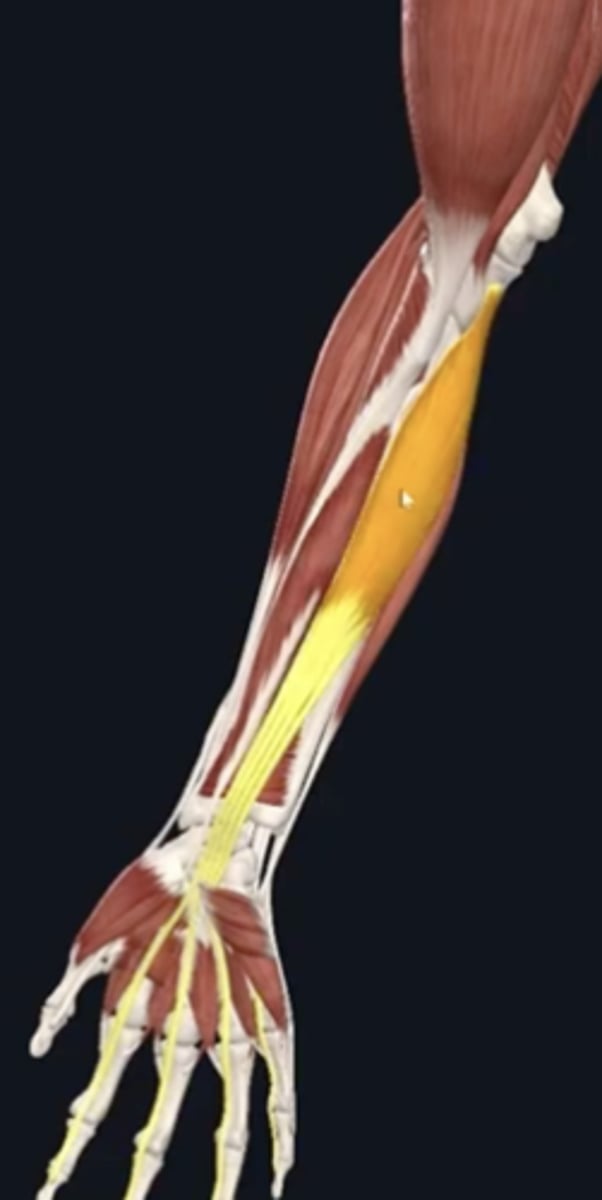 <p>Makes up one of the two deepest "layer" muscles of the forearm flexors, deep to the FDS</p><p>appears as shiny white</p><p>Flexor of hand and digits of wrist</p><p>Proximal to ulna</p><p>Distal to distal phalanges 2-5</p>