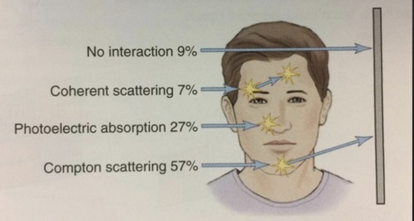 <p>eyebrow/forehead region <br>7%</p>