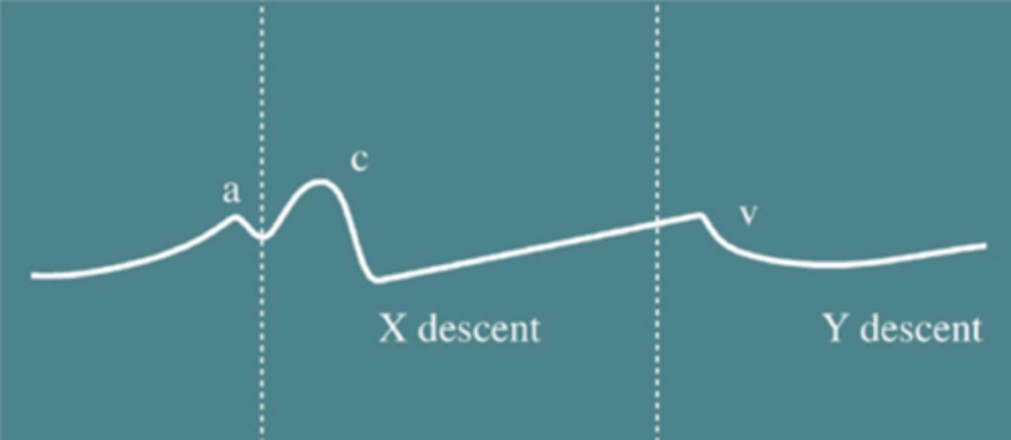 <p>A wave: atrial contraction (occurs during diastole- AV valves are open)</p><p>C wave: ventricular contraction, pushes AV valves up into the atrium (occurs during systole- AV valves are closed)</p><p>V wave: atrial pressure > ventricular pressure due to passive filling during the diastole phase (AV valves are about to open)</p><p>Blood fills into atria during systole when ventricles are contracting (between C and V waves) </p>
