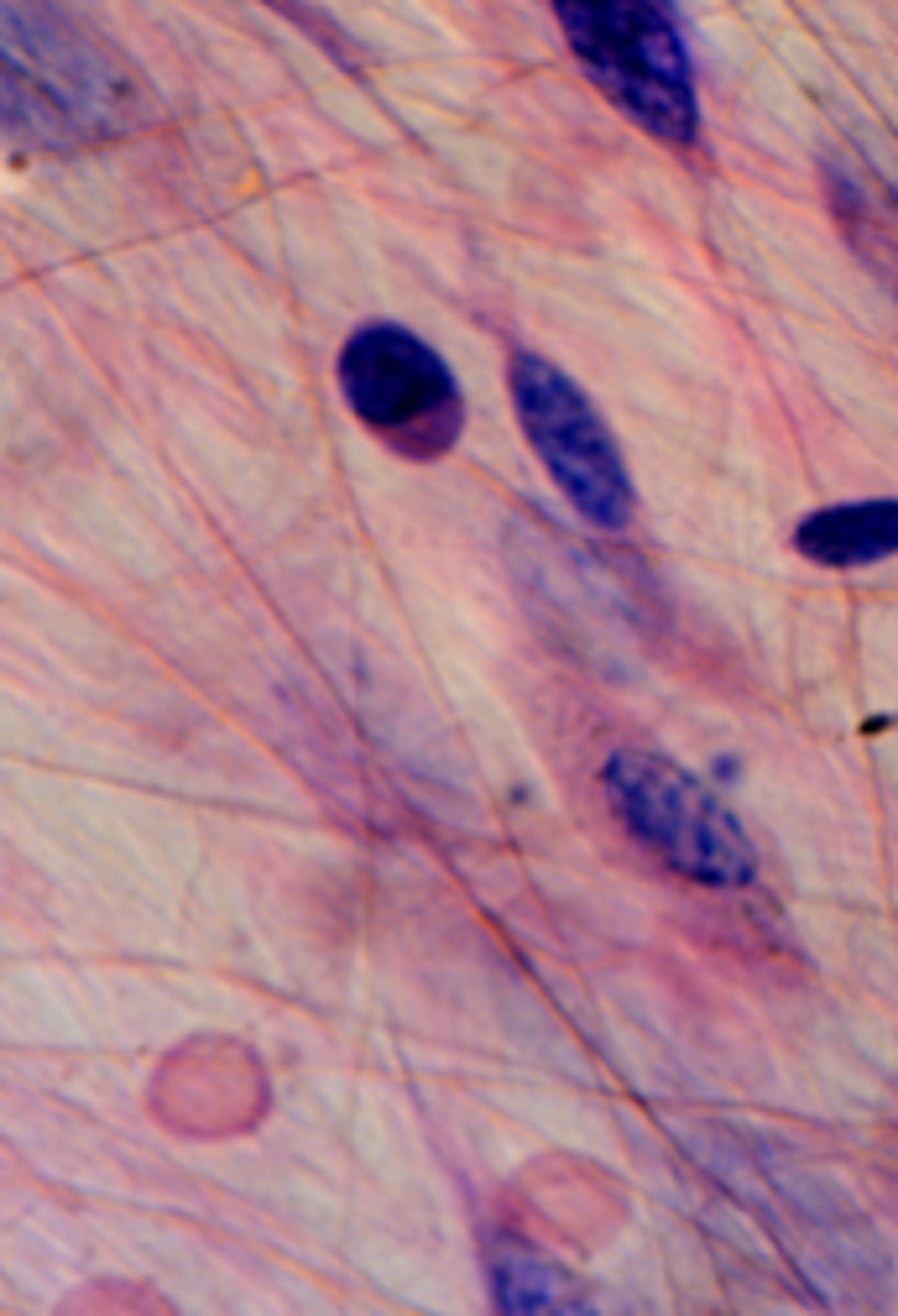 <p>What tissue is shown?</p>