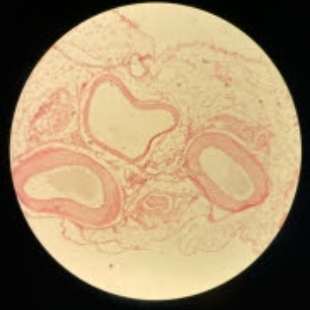 term image