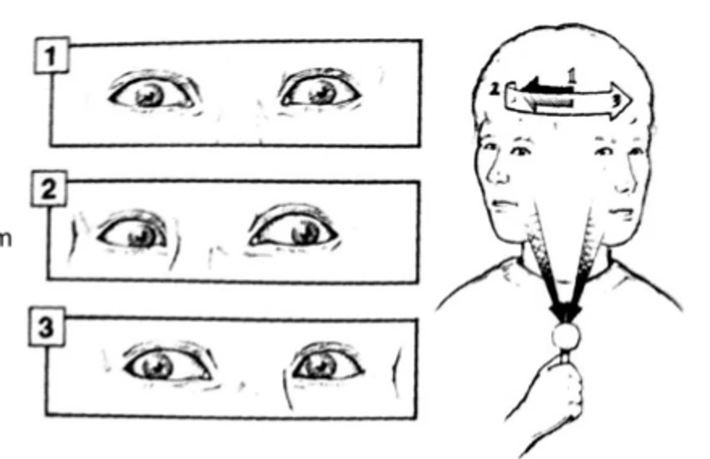 <p>ability to maintain gaze or visual focus on an external target during movement</p>