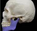<p>lower jaw bone</p>