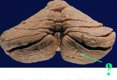 <p><span><span>Identify the indicated lobe of the cerebellum.</span></span></p>